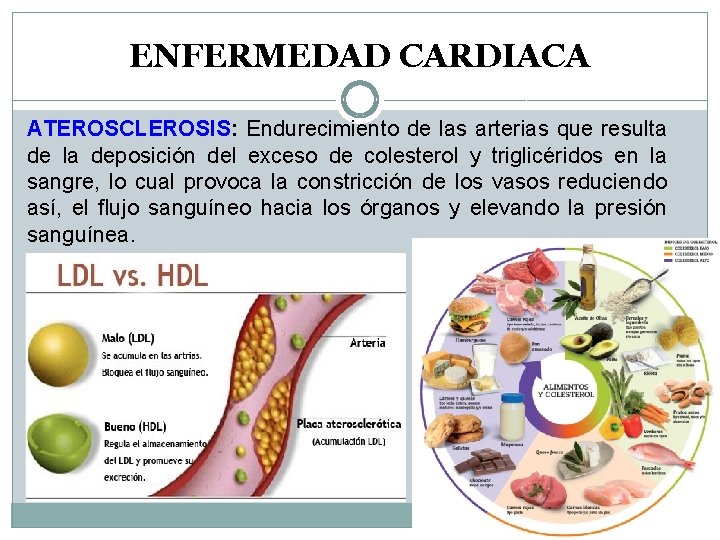 ENFERMEDAD CARDIACA ATEROSCLEROSIS: Endurecimiento de las arterias que resulta de la deposición del exceso