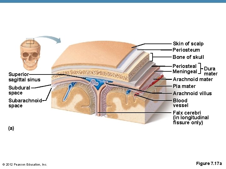 Skin of scalp Periosteum Bone of skull Superior sagittal sinus Subdural space Subarachnoid space