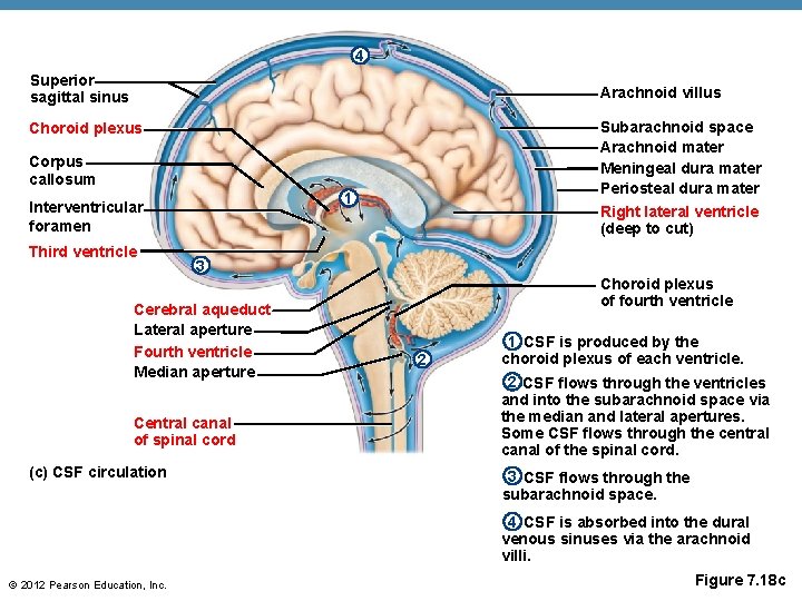 4 Superior sagittal sinus Arachnoid villus Subarachnoid space Arachnoid mater Meningeal dura mater Periosteal