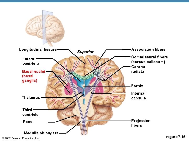 Longitudinal fissure Lateral ventricle Basal nuclei (basal ganglia) Superior Association fibers Commissural fibers (corpus