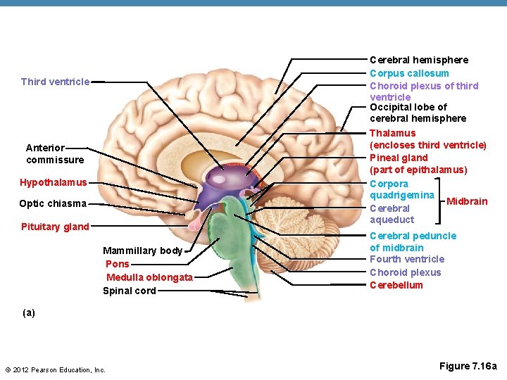 Cerebral hemisphere Corpus callosum Choroid plexus of third ventricle Occipital lobe of cerebral hemisphere