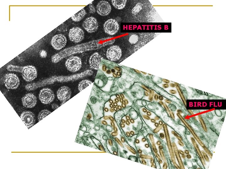 HEPATITIS B BIRD FLU 