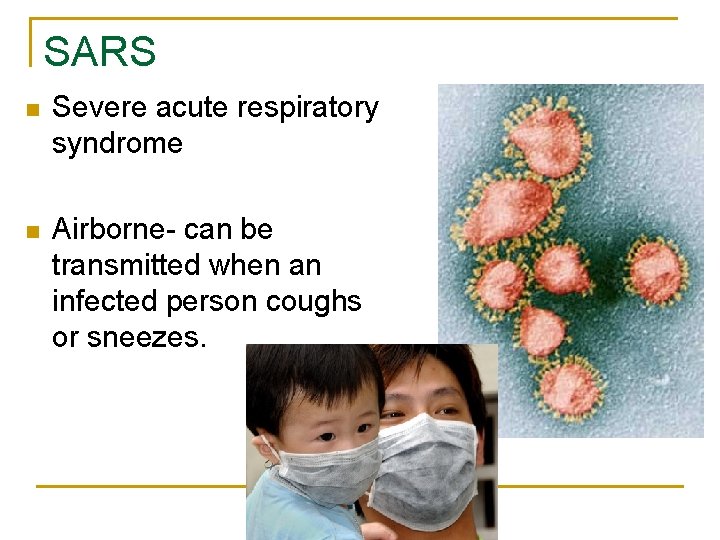 SARS n Severe acute respiratory syndrome n Airborne- can be transmitted when an infected