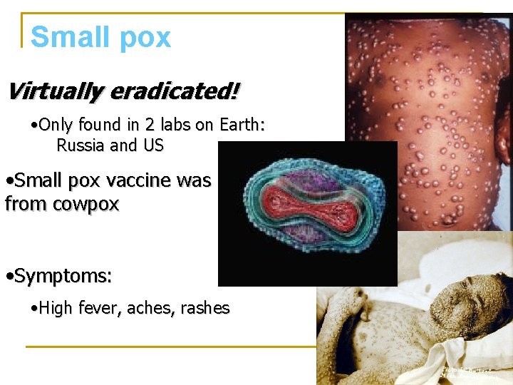 Small pox Virtually eradicated! • Only found in 2 labs on Earth: Russia and