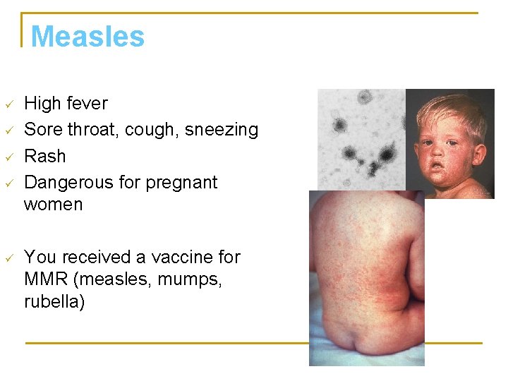 Measles ü ü ü High fever Sore throat, cough, sneezing Rash Dangerous for pregnant