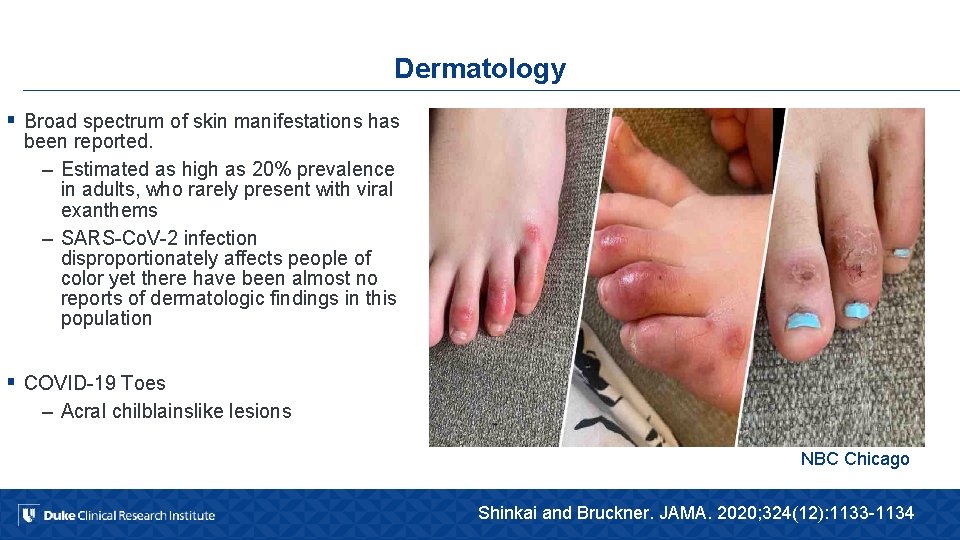 Dermatology § Broad spectrum of skin manifestations has been reported. – Estimated as high