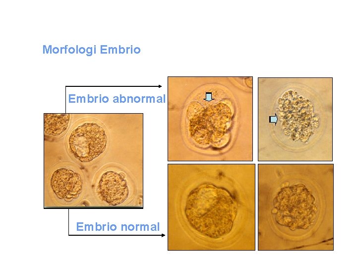 Morfologi Embrio abnormal Embrio normal 