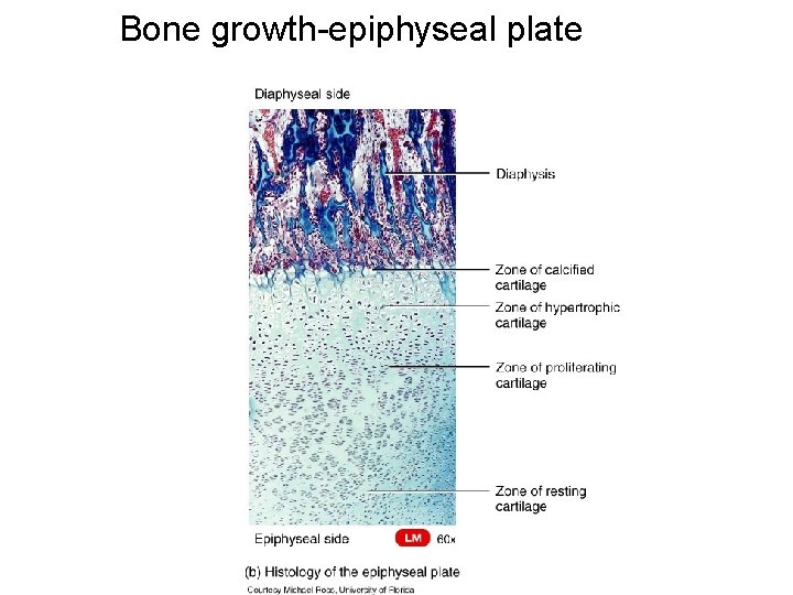 Bone growth-epiphyseal plate 
