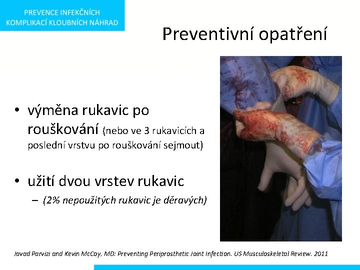 Preventivní opatření • výměna rukavic po rouškování (nebo ve 3 rukavicích a poslední vrstvu