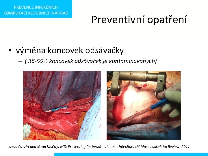 Preventivní opatření • výměna koncovek odsávačky – ( 36 -55% koncovek odsávaček je kontaminovaných)