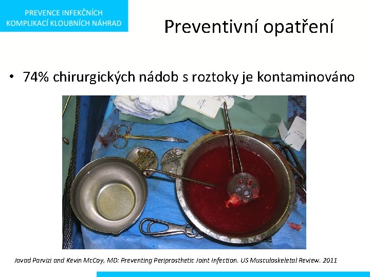 Preventivní opatření • 74% chirurgických nádob s roztoky je kontaminováno Javad Parvizi and Kevin