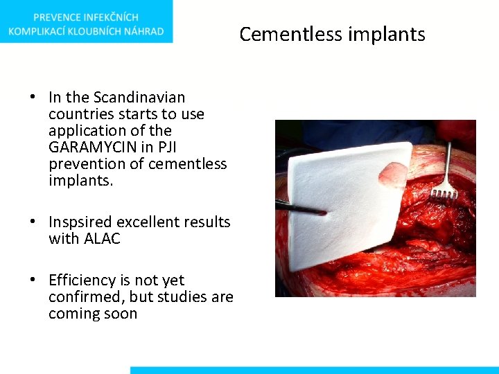 Cementless implants • In the Scandinavian countries starts to use application of the GARAMYCIN