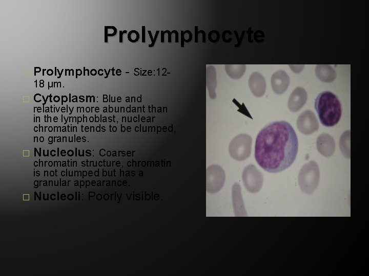 Prolymphocyte - Size: 1218 µm. � Cytoplasm: Blue and � relatively more abundant than