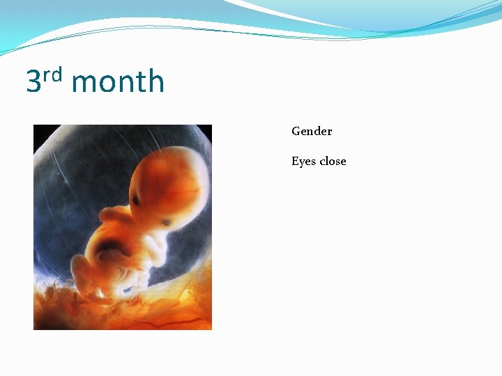 rd 3 month Gender Eyes close 