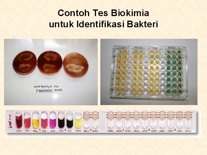 Contoh Tes Biokimia untuk Identifikasi Bakteri 