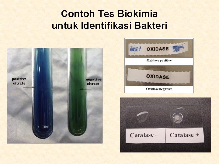 Contoh Tes Biokimia untuk Identifikasi Bakteri 