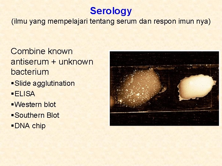 Serology (ilmu yang mempelajari tentang serum dan respon imun nya) Combine known antiserum +