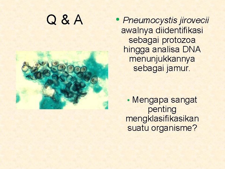 Q&A • Pneumocystis jirovecii awalnya diidentifikasi sebagai protozoa hingga analisa DNA menunjukkannya sebagai jamur.