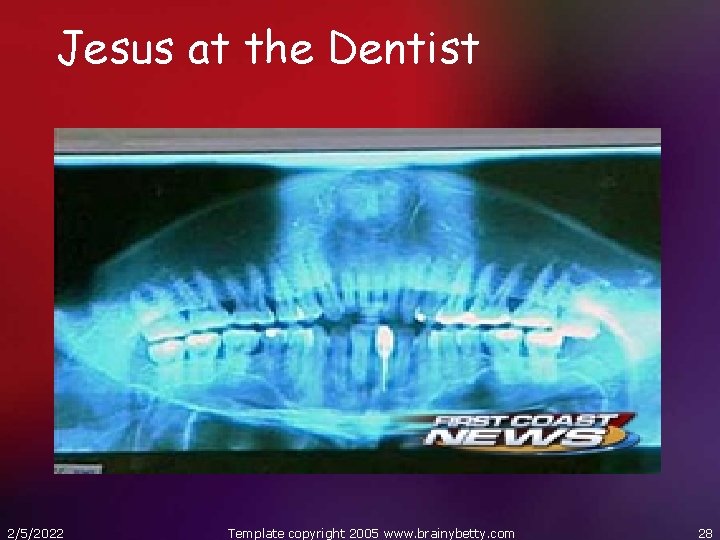 Jesus at the Dentist 2/5/2022 Template copyright 2005 www. brainybetty. com 28 