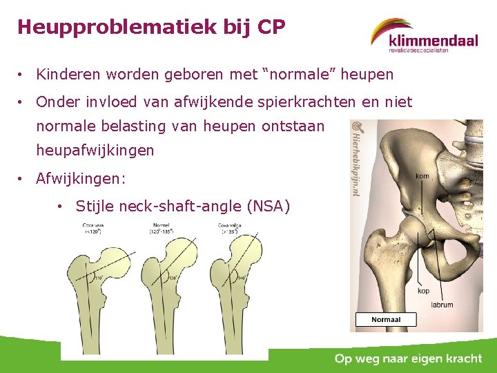 Heupproblematiek bij CP • Kinderen worden geboren met “normale” heupen • Onder invloed van