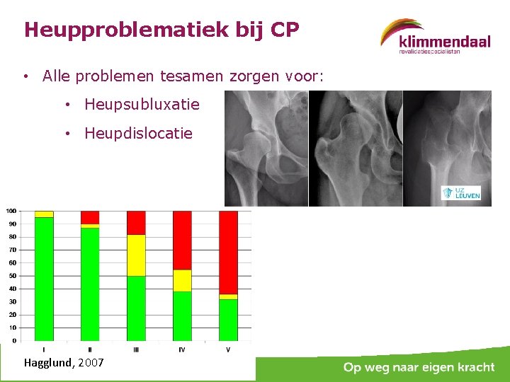 Heupproblematiek bij CP • Alle problemen tesamen zorgen voor: • Heupsubluxatie • Heupdislocatie Hagglund,