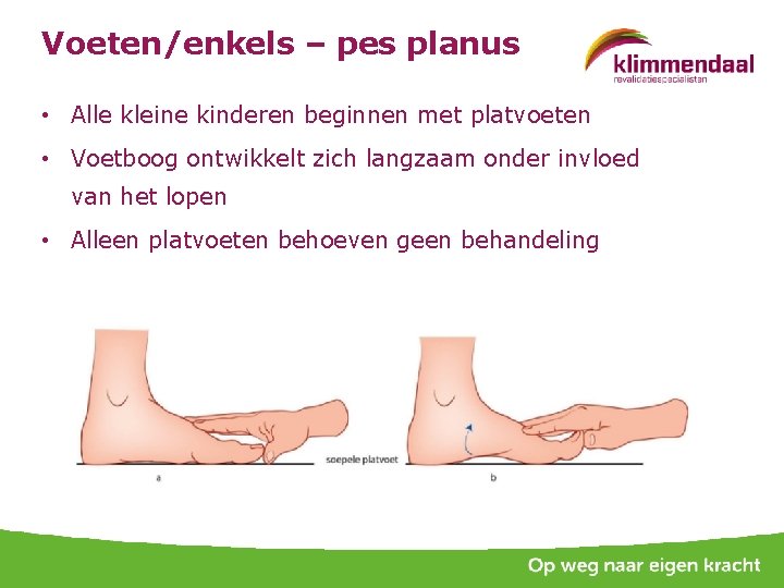 Voeten/enkels – pes planus • Alle kleine kinderen beginnen met platvoeten • Voetboog ontwikkelt