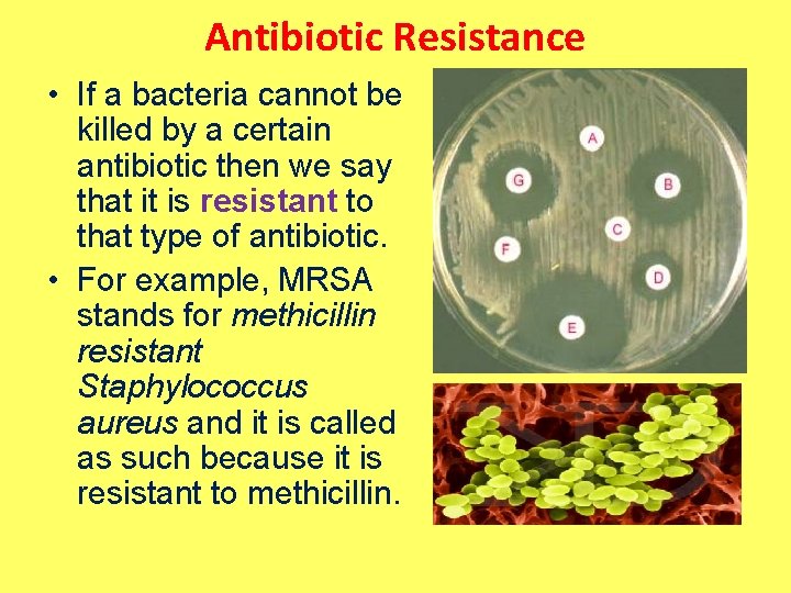 Antibiotic Resistance • If a bacteria cannot be killed by a certain antibiotic then