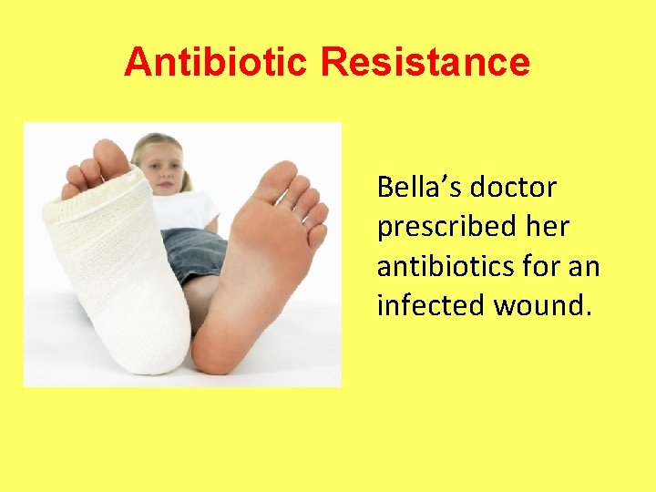 Antibiotic Resistance Bella’s doctor prescribed her antibiotics for an infected wound. 