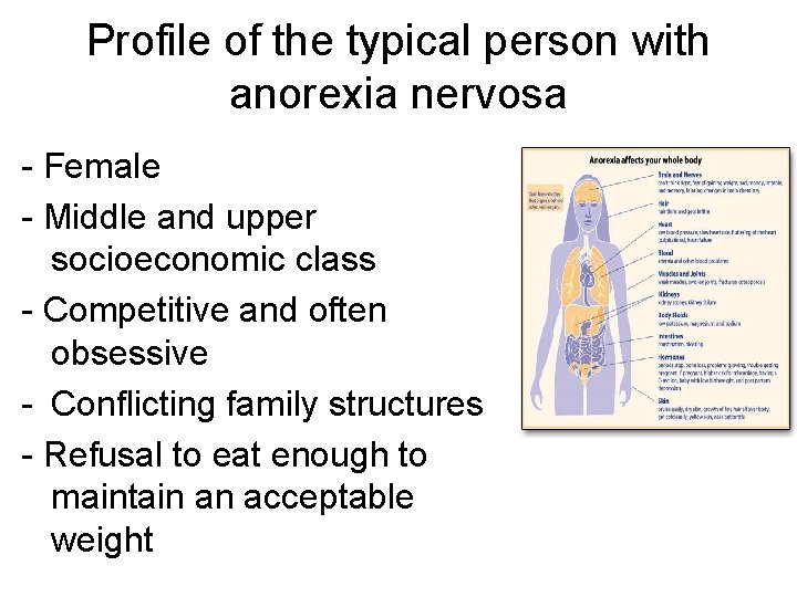 Profile of the typical person with anorexia nervosa - Female - Middle and upper