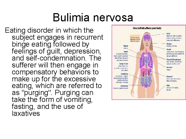 Bulimia nervosa Eating disorder in which the subject engages in recurrent binge eating followed