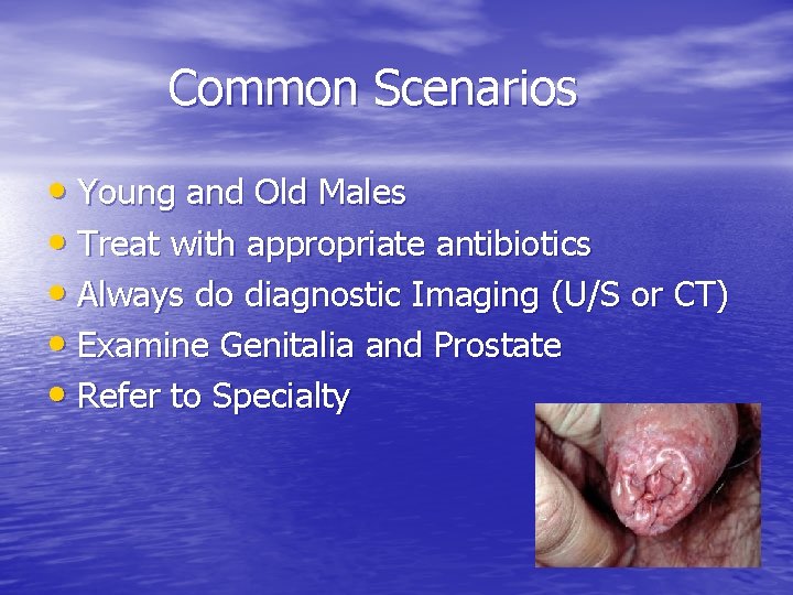 Common Scenarios • Young and Old Males • Treat with appropriate antibiotics • Always