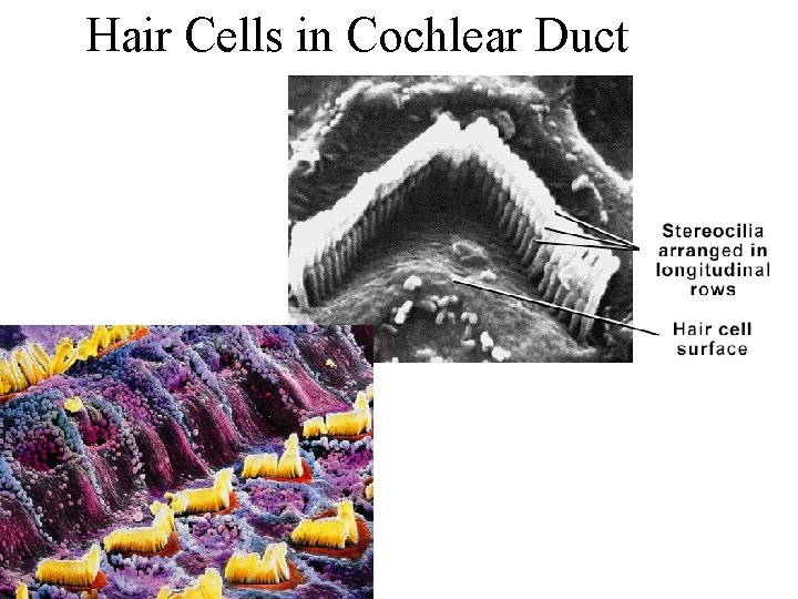 Hair Cells in Cochlear Duct 