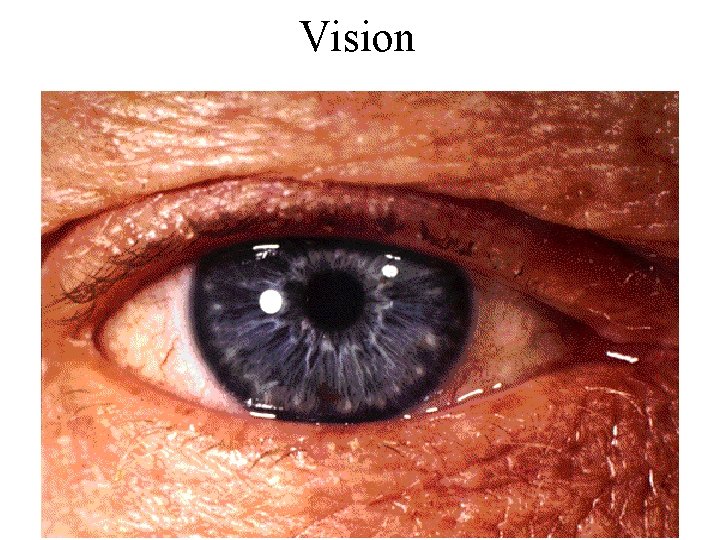Vision 