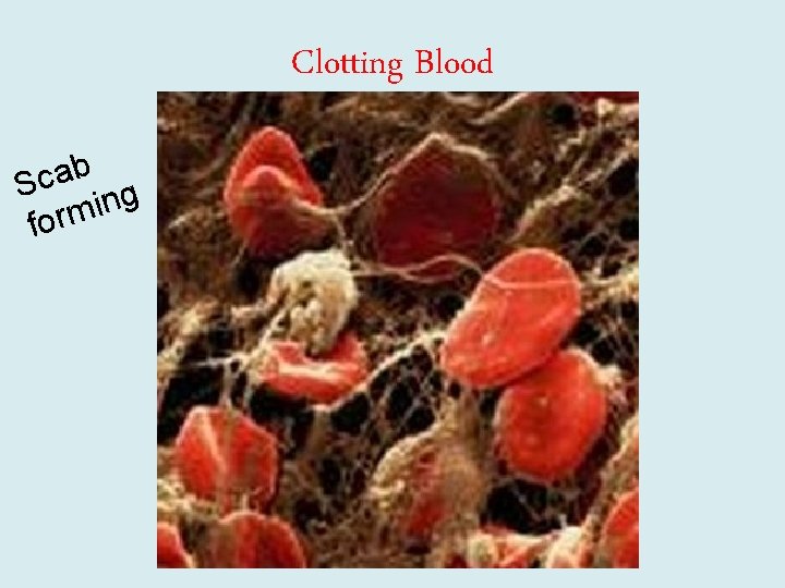 b a c • S g n i form Clotting Blood 