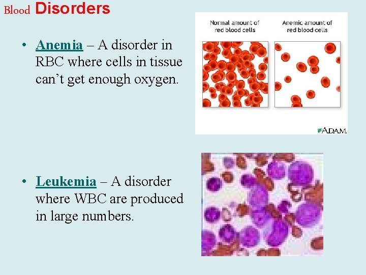 Blood Disorders • Anemia – A disorder in RBC where cells in tissue can’t