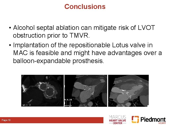 Conclusions • Alcohol septal ablation can mitigate risk of LVOT obstruction prior to TMVR. Conclusions • Alcohol septal ablation can mitigate risk of LVOT obstruction prior to TMVR.