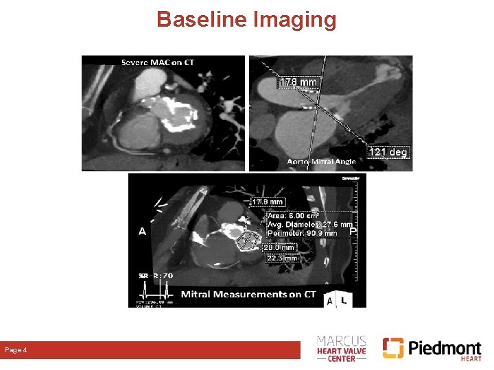 Baseline Imaging Page 4 Baseline Imaging Page 4