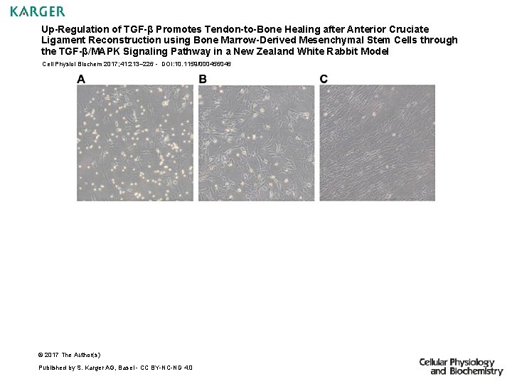 Up-Regulation of TGF-β Promotes Tendon-to-Bone Healing after Anterior Cruciate Ligament Reconstruction using Bone Marrow-Derived