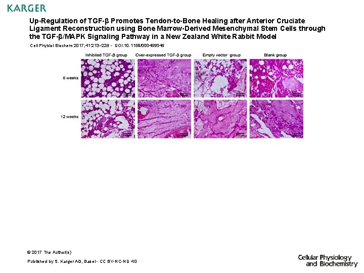 Up-Regulation of TGF-β Promotes Tendon-to-Bone Healing after Anterior Cruciate Ligament Reconstruction using Bone Marrow-Derived