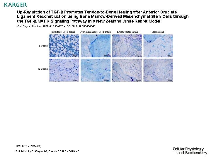Up-Regulation of TGF-β Promotes Tendon-to-Bone Healing after Anterior Cruciate Ligament Reconstruction using Bone Marrow-Derived