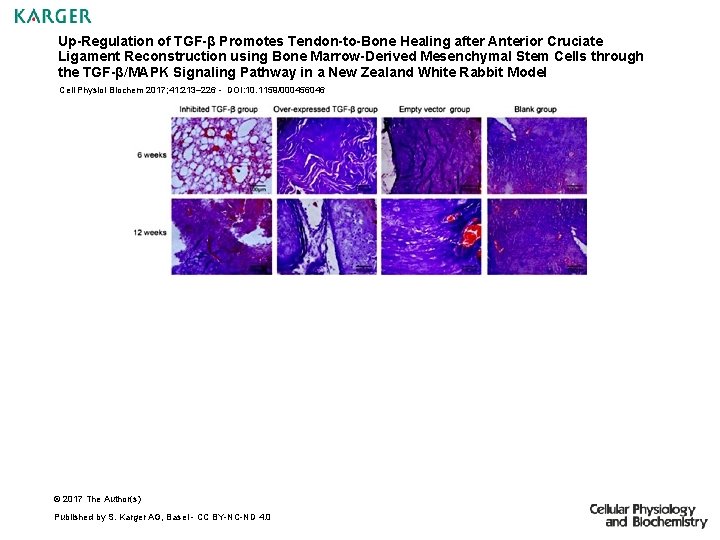 Up-Regulation of TGF-β Promotes Tendon-to-Bone Healing after Anterior Cruciate Ligament Reconstruction using Bone Marrow-Derived