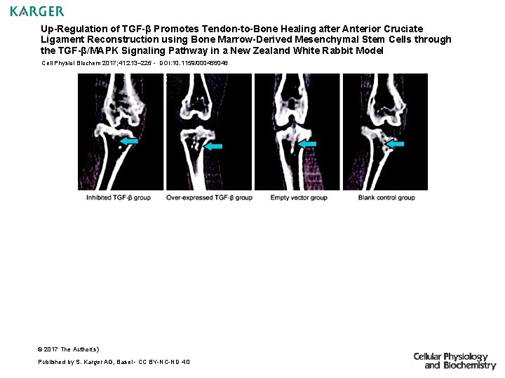 Up-Regulation of TGF-β Promotes Tendon-to-Bone Healing after Anterior Cruciate Ligament Reconstruction using Bone Marrow-Derived