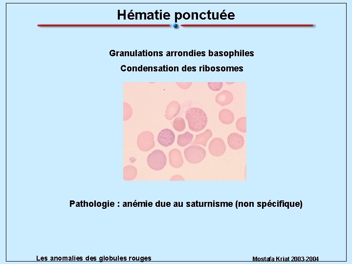 Hématie ponctuée Granulations arrondies basophiles Condensation des ribosomes Pathologie : anémie due au saturnisme