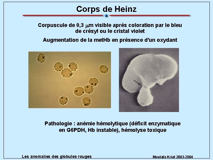 Corps de Heinz Corpuscule de 0, 3 mm visible après coloration par le bleu