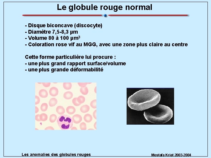 Le globule rouge normal - Disque biconcave (discocyte) - Diamètre 7, 5 -8, 3
