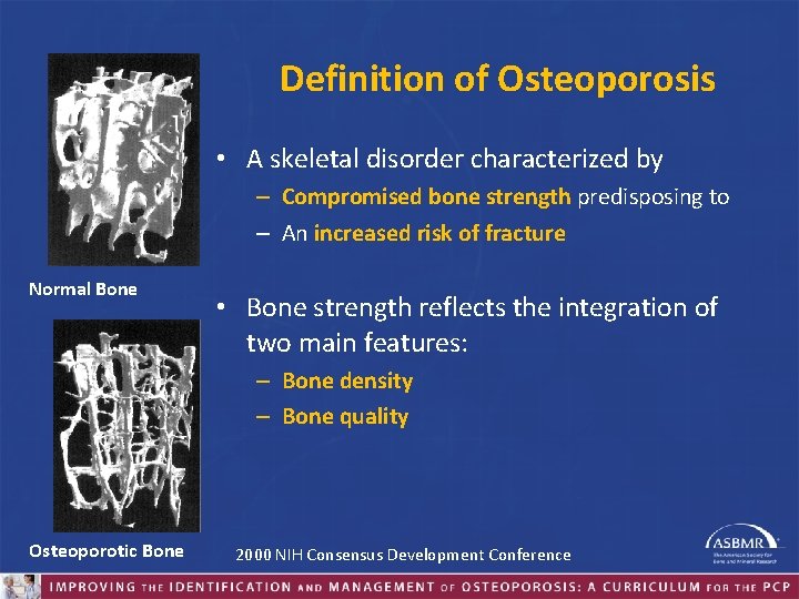 Definition of Osteoporosis • A skeletal disorder characterized by – Compromised bone strength predisposing