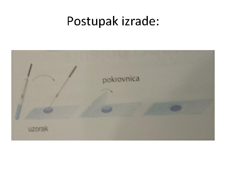 Postupak izrade: 