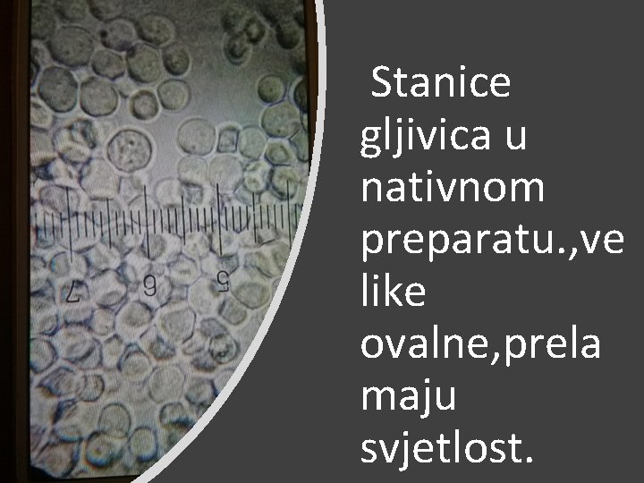 Stanice gljivica u nativnom preparatu. , ve like ovalne, prela maju svjetlost. 