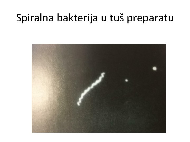 Spiralna bakterija u tuš preparatu 