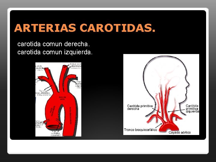 ARTERIAS CAROTIDAS. carotida comun derecha. carotida comun izquierda. 